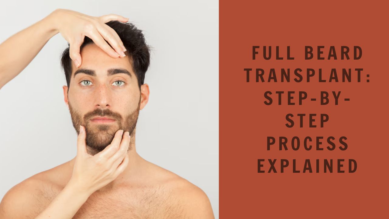 Full Beard Transplant: Step-by-Step Process Explained