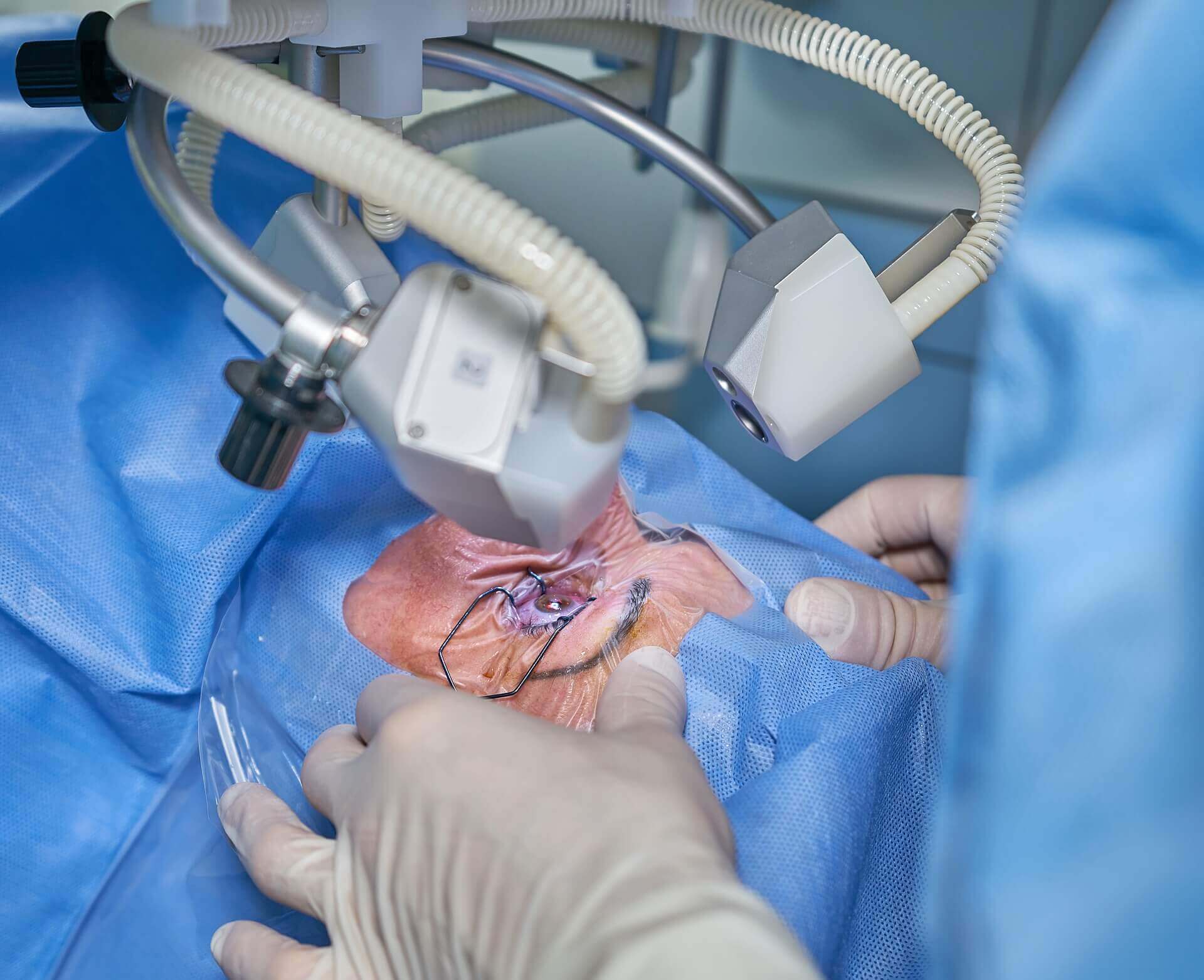 Retina Surgery in Kerala: Save Your Vision