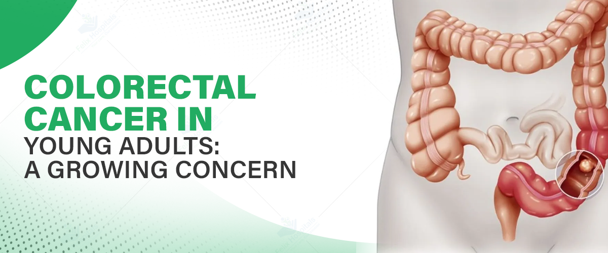 Colorectal Cancer Treatment in Noida: Advanced Care